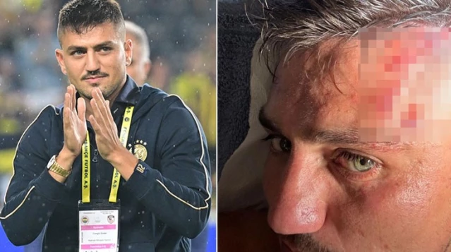 Fenerbahçe'nin yeni yıldızı Cengiz Ünder, sakatlık yaşadı