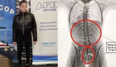 Arjantin Havalimanında 20 Yaşındaki Kadın Vajina ve Midesine Sakladığı Kokainle Yakalandı